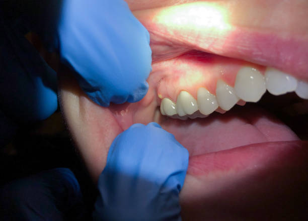Best Tooth Infection Emergency Dentist  in Stuttgt, AR