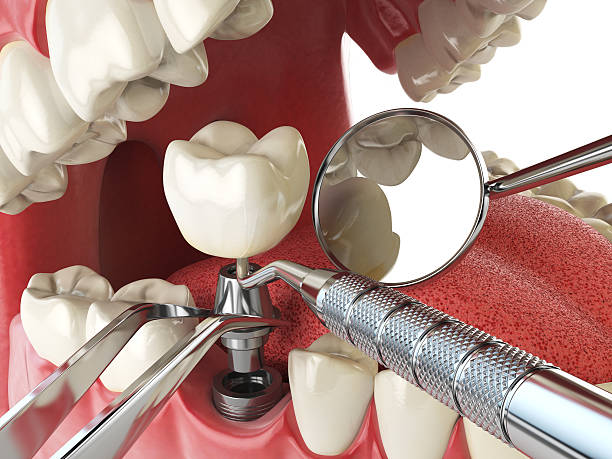 Best Knocked-Out Tooth Emergency  in Stuttgt, AR